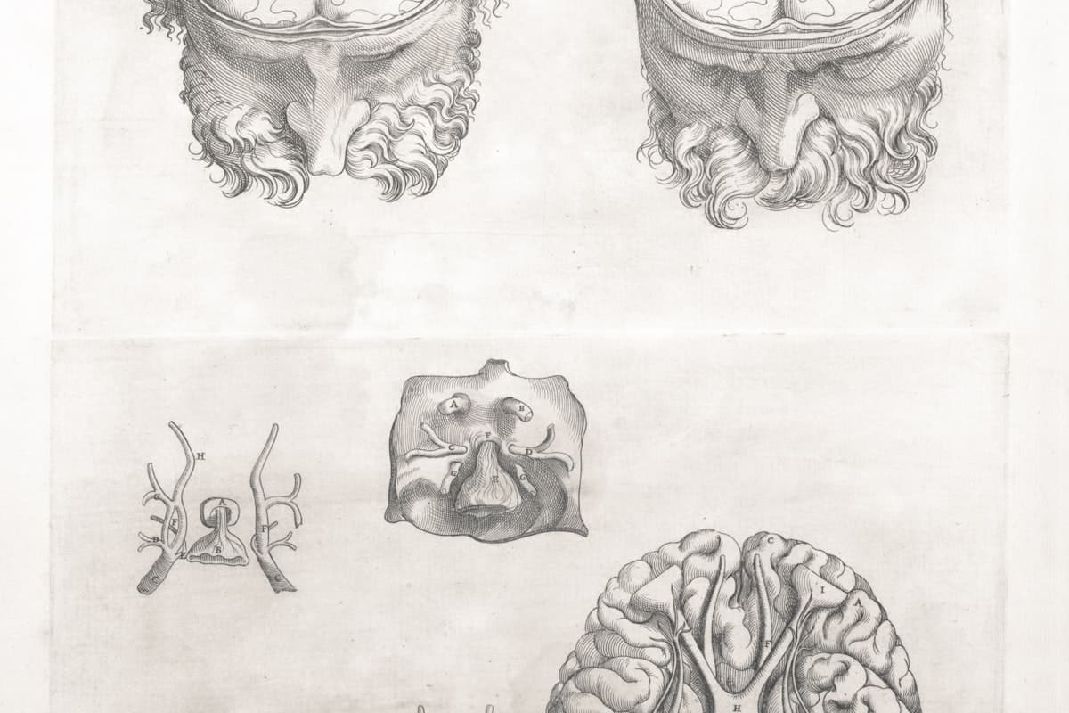 Heart Valve Repair & Replacement in Turkey