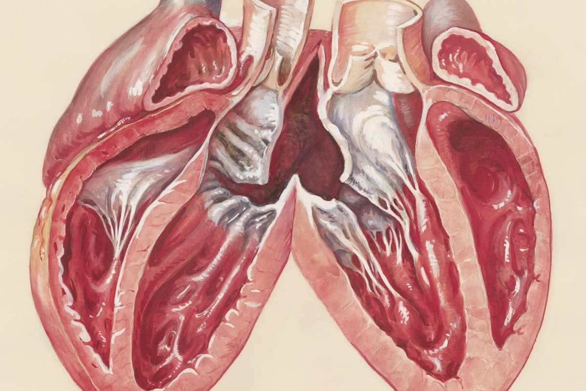 TAVI (Transcatheter Aortic Valve Implantation) in Turkey
